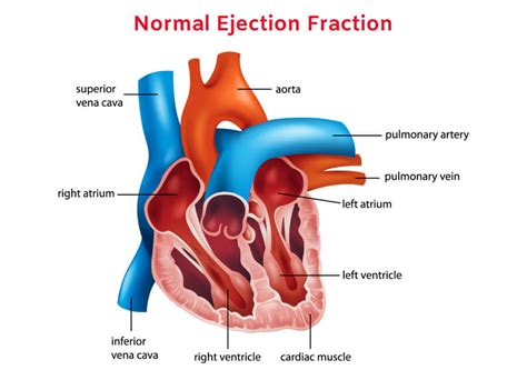 Ejection Fraction: What It Is, Types and Normal Range